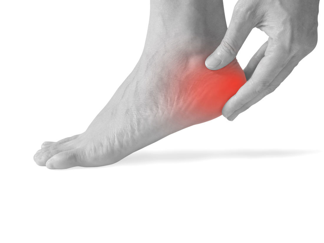 Plantar Fasciitis: Causes, Symptoms & Treatment | The Feet People  Podiatry